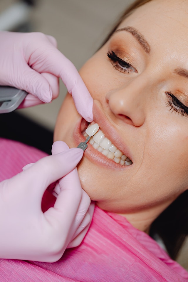 How to Take Care of Your Veneers After the Procedure